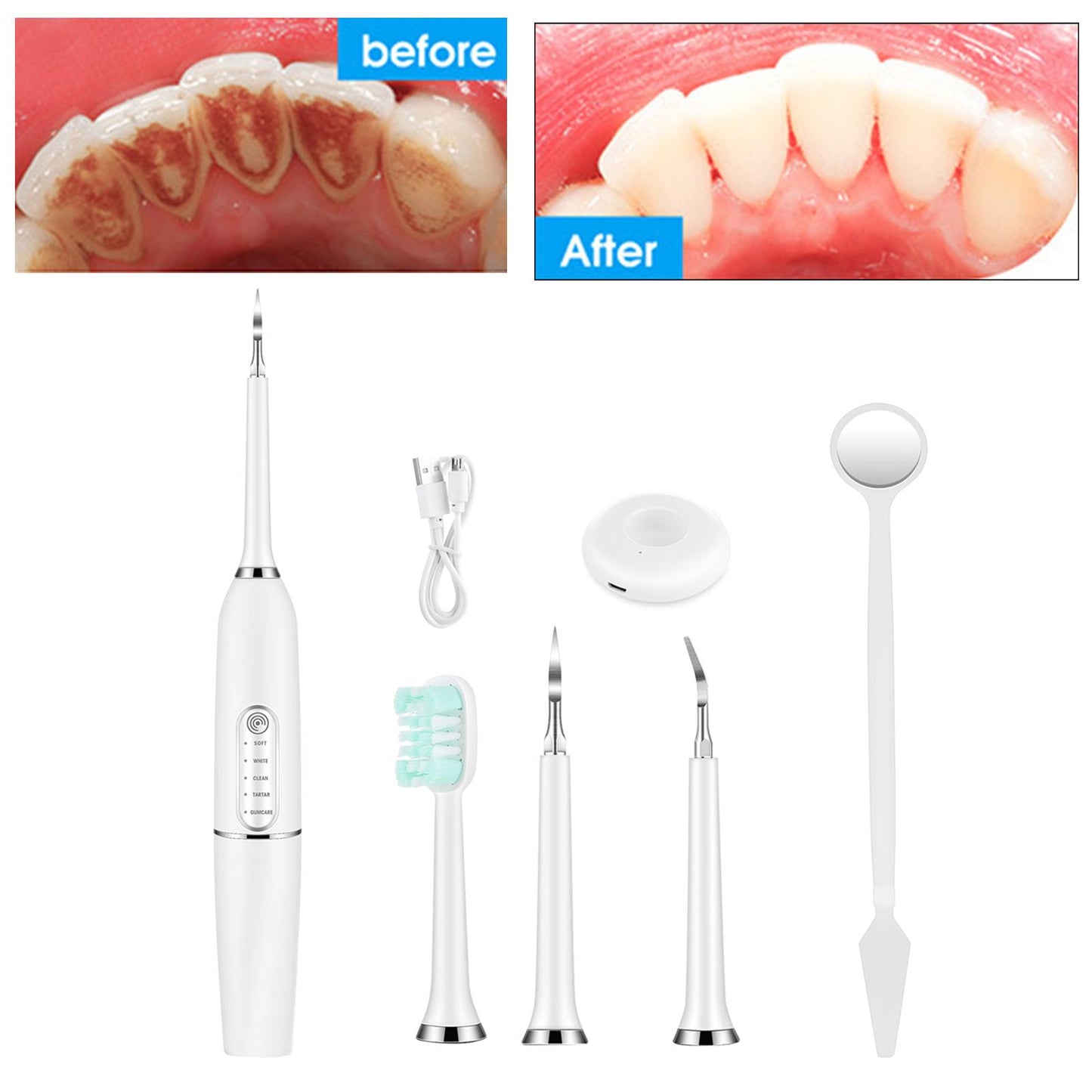 Sonic Dental Calculus Scaler USB Charging for Adult Kids Teeth Cleaner White