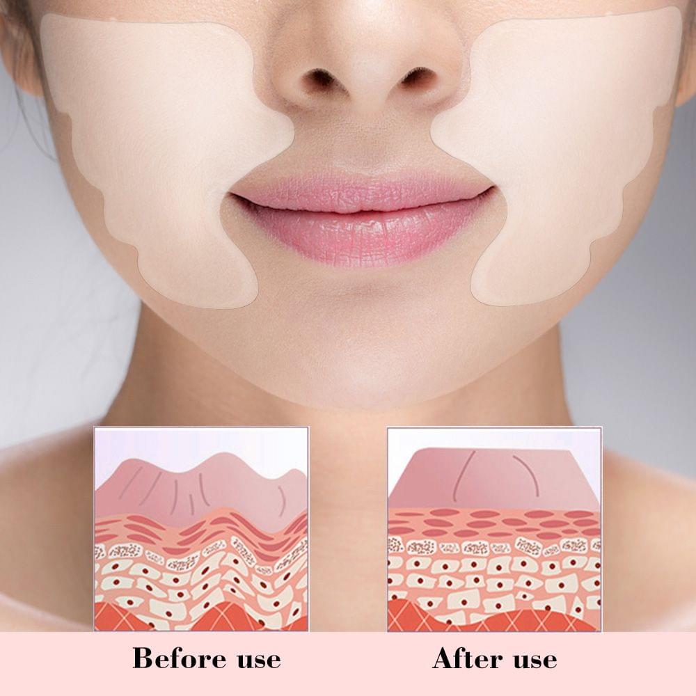 Facial Lip Wrinkle Remover Pad Reusable Medical Grade
