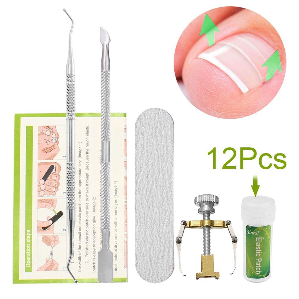 Ingrown Toenail Correction Set Toenail Treatment Toenail - 01(12pcs)